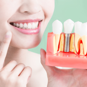 dental implants Replace Your Missing Teeth With Dental Implants Lake of the pines dental dentist in Auburn California